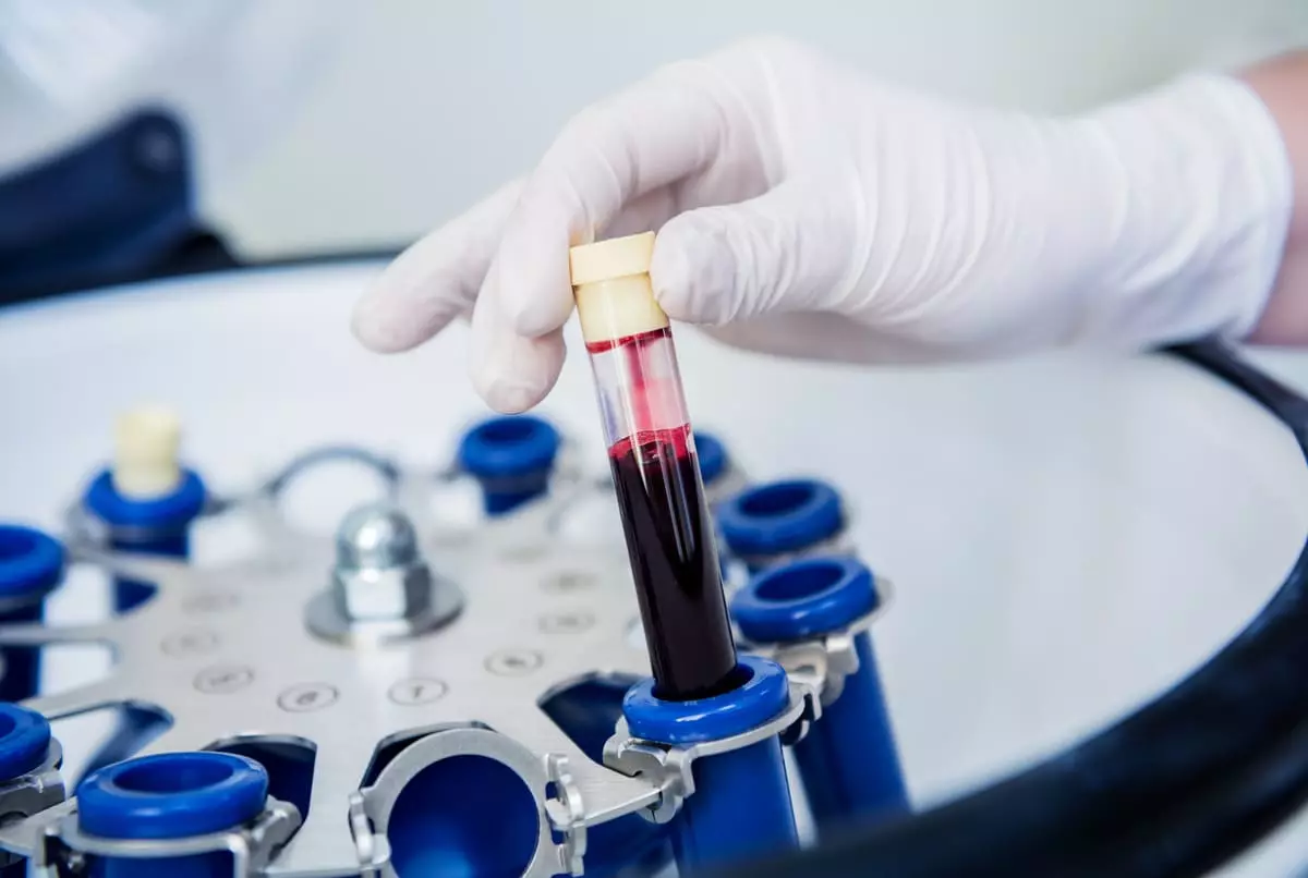 Medicina estética regenerativa