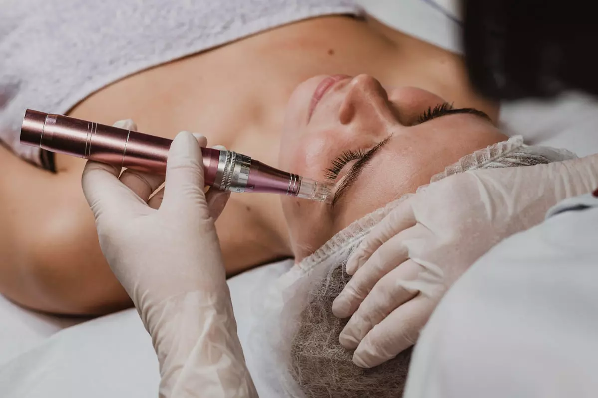 Tratamiento con exoxomas